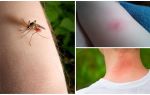Quina diferència hi ha entre una mossegada de mosquits i una picada de mosquits?