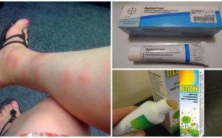 Per què en adults i nens després de les picades de mosquits apareixen sots que per tractar